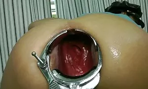 Ananın anal yumruğu  ...